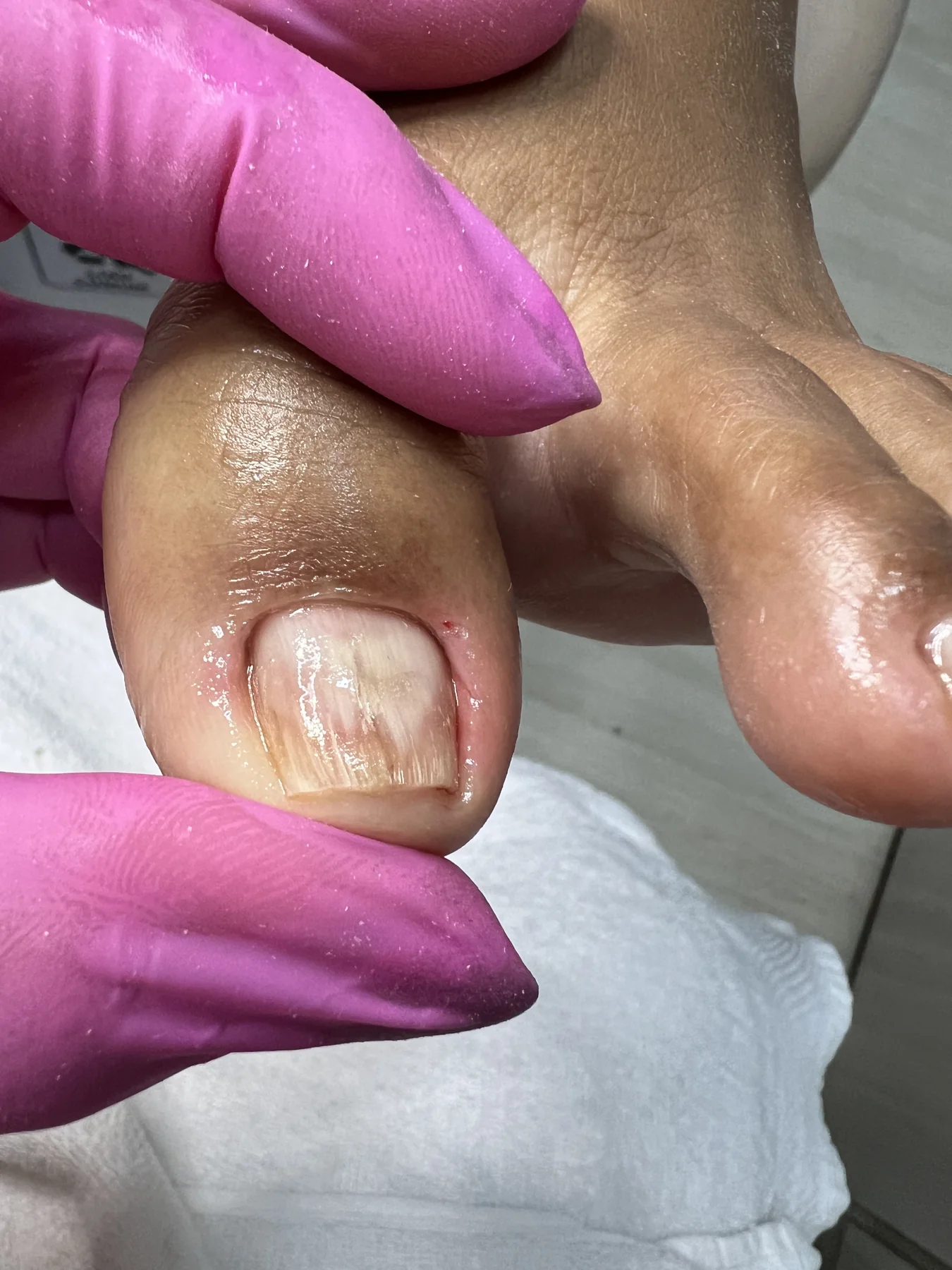 Cuidado técnico na lateral da unha, com delicadeza